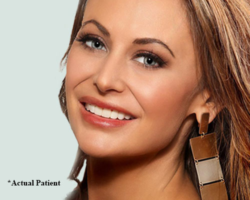 fort mill dentist actual patient
